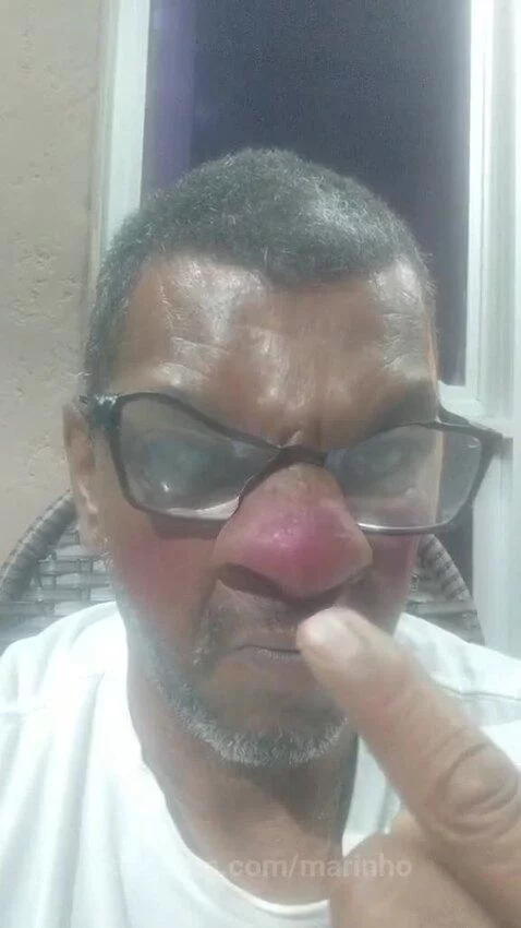 Dói muito by marinho