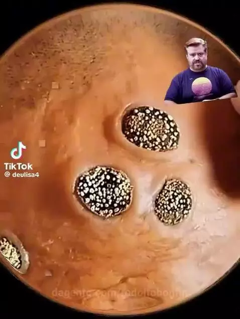 video poster