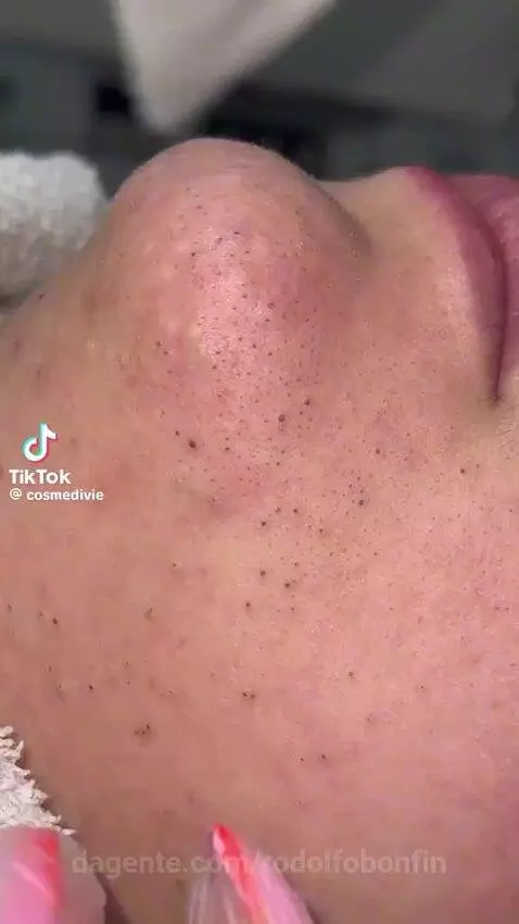 video poster