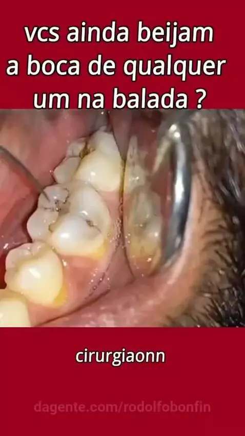 video poster
