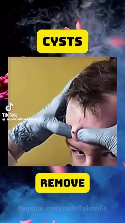 video poster