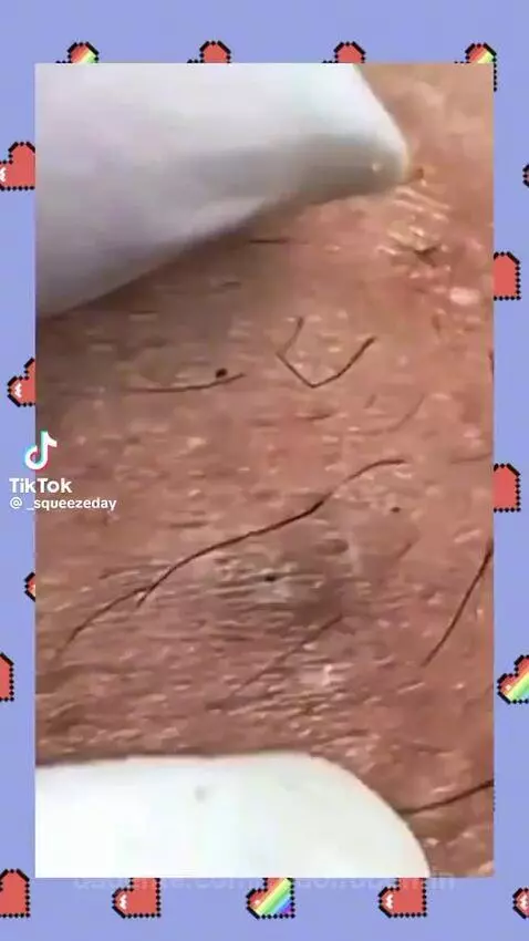 video poster