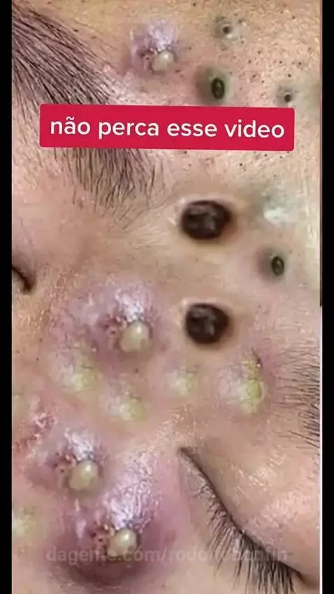 video poster