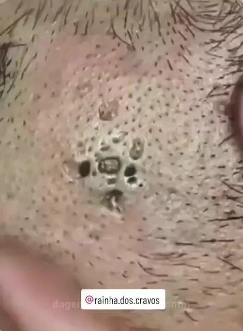 video poster